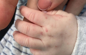 Скандал в Станишівській лікарні: житомирянка заявила про насилля над одномісячним сином
