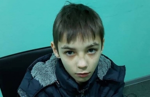 У Житомирі зник 13-річний школяр: поліція оголосила розшук
