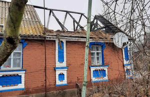 У Житомирській області чоловік отримав опіки, рятуючи свій будинок від пожежі