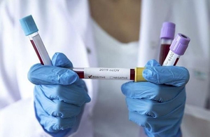 МОЗ направить до Житомира тест-системи для виявлення коронавіруса