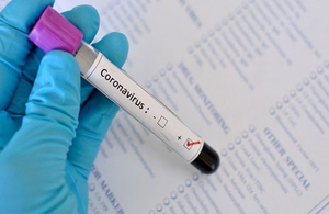 Житомир не дочекався від МОЗ тести на коронавірус і придбав їх самостійно