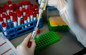 На Житомирщині підтвердили ще один випадок коронавірусу: інфікувалася жінка