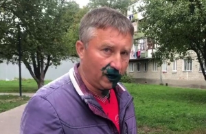 Група молодиків напала на депутата Житомирської мерії і облила зеленкою. ВІДЕО