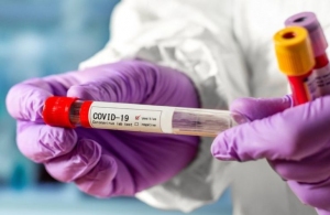 Житомирський центр крові закупив за завищеними цінами тести на антитіла до коронавірусу – ЗМІ