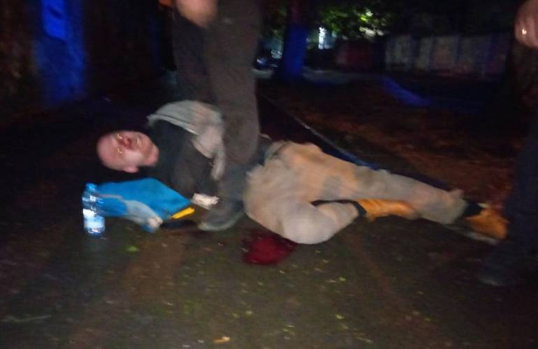 «Дали мне в нос. Я потерял сознание»: в столице полицейские жестоко избили житомирянина Митю Бугайчука