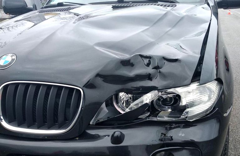 На трассе возле Житомира BMW сбил женщину: от полученных травм она скончалась