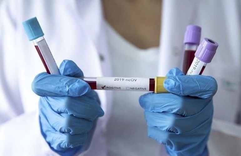 В Украине зафиксировали новые случаи инфицирования коронавирусом