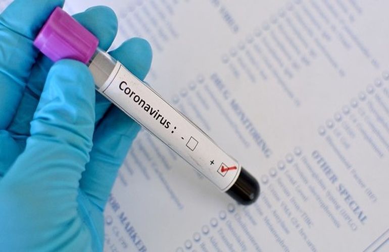 Житомир не дождался от МОЗ тесты на коронавирус и приобрел их самостоятельно