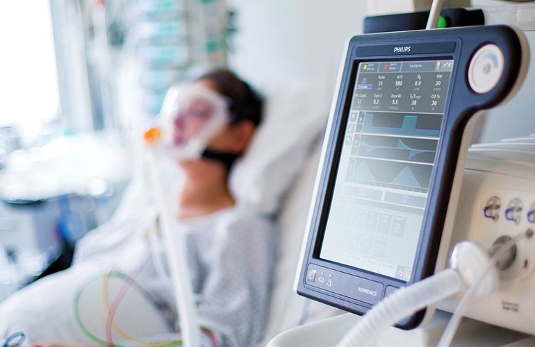 В ОГА рассказали, сколько аппаратов искусственной вентиляции легких имеют больницы Житомирщины