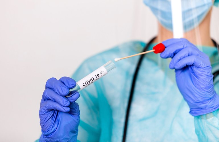 Житомирский лабораторный центр на 160 грн снизил цену ПЦР-теста на коронавирус